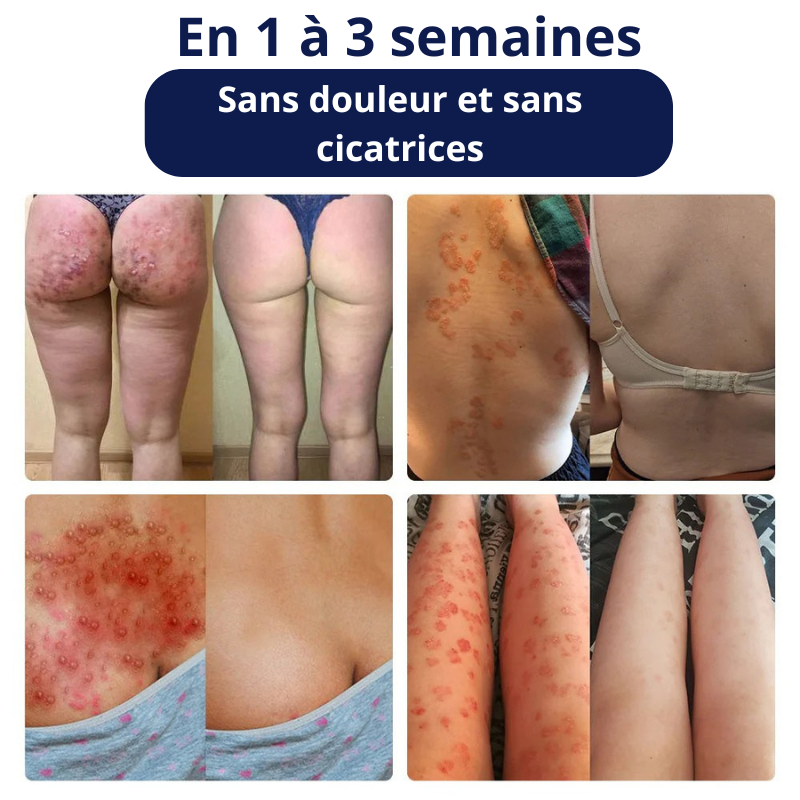 Crème réparatrice au venin d’abeille