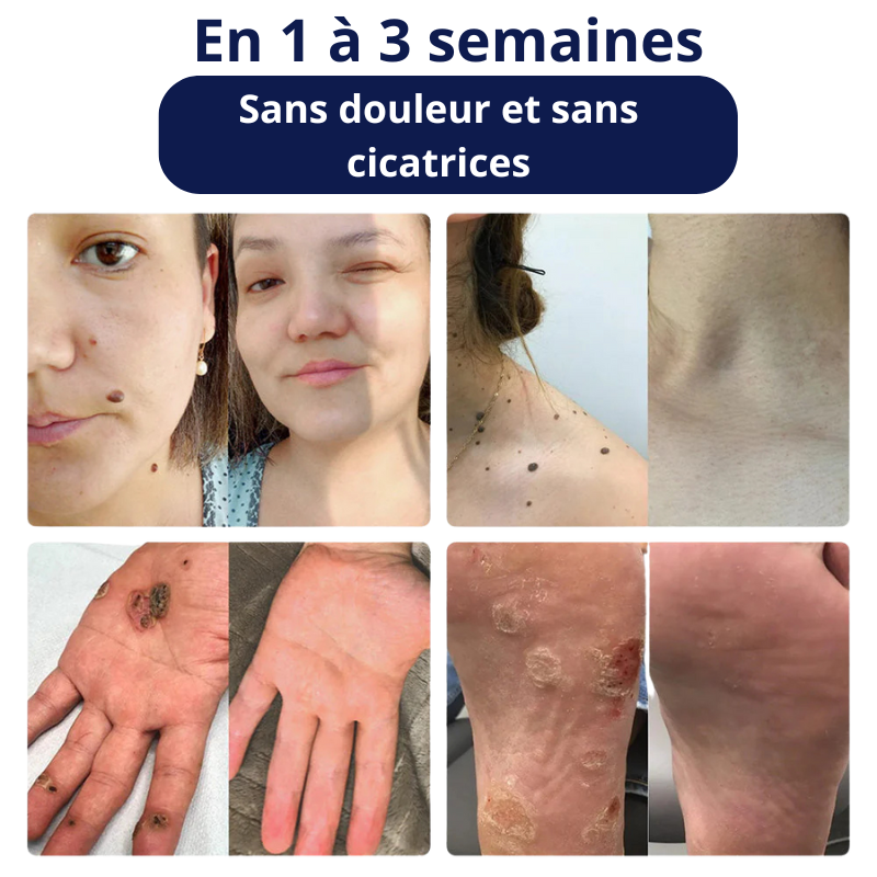 Crème réparatrice au venin d’abeille