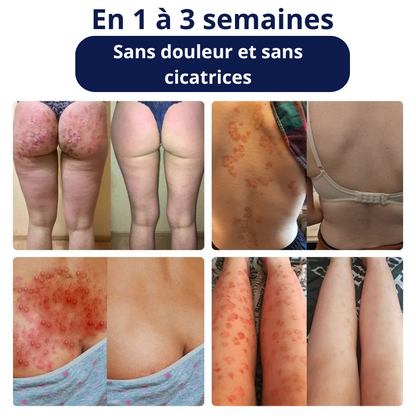 Crème réparatrice au venin d’abeille